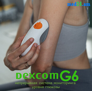 dexcom, dexcomg6, g6, мониторинг, глюкозы