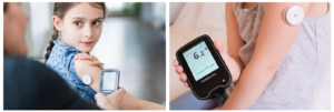 շաքարախտ, Freestyle Libre, Dexcom, շաքարի մոնիտորինգ, շարունակական մոնիտորինգ, երեխաների շաքարախտ, դպրոցական շաքարախտ, շաքարի մակարդակի վերահսկում, CGM համակարգ, հիպոգլիկեմիա, հիպերգլիկեմիա, դպրոցական ծրագիր, ֆիզիկական ակտիվություն և շաքար, սնունդ շաքարախտի համար, սենսորներ շաքարախտի համար, տրանսմիտերներ, ֆիքսող սոսինձներ, Med24.am։