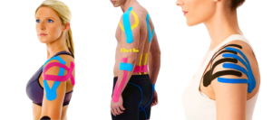 թեյփ սենսորների համար, Freestyle Libre, Dexcom, դիաբետի համար թեյփ, սենսորի պաշտպանություն, ջրակայուն թեյփ, սենսորի ամրացում, թեյփ մարզիկների համար, թեյփ լողի համար, Med24.am, սենսորի երկարատև օգտագործում, դիաբետիկ աքսեսուարներ, սենսորի ամրացման միջոց.